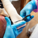Epidermolysis Bullosa